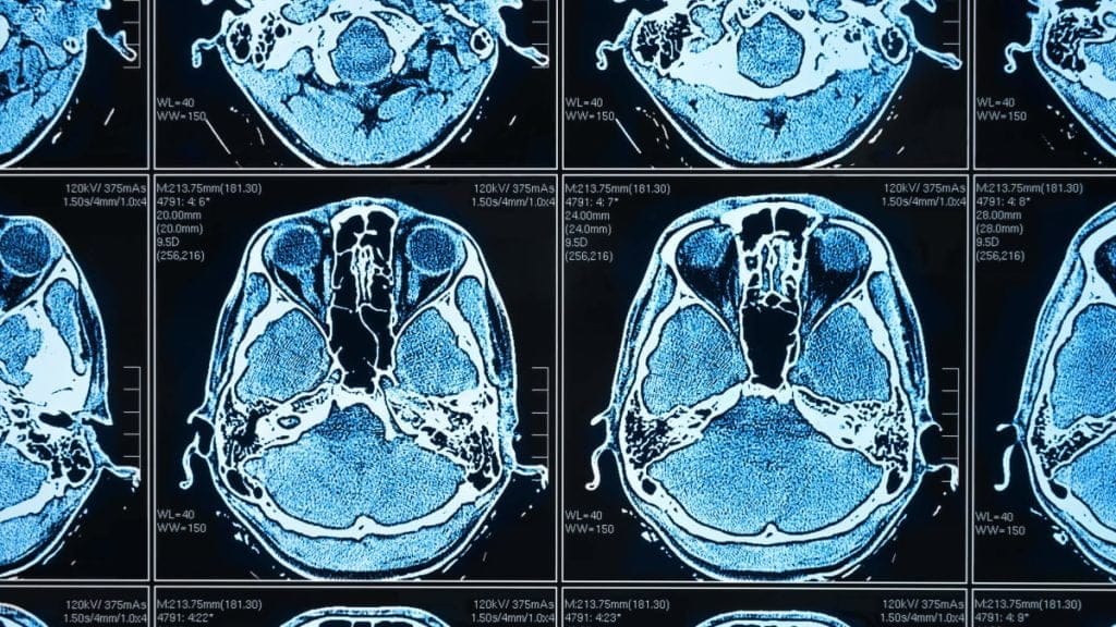 Dette billede illustrere AI inom medicinteknik