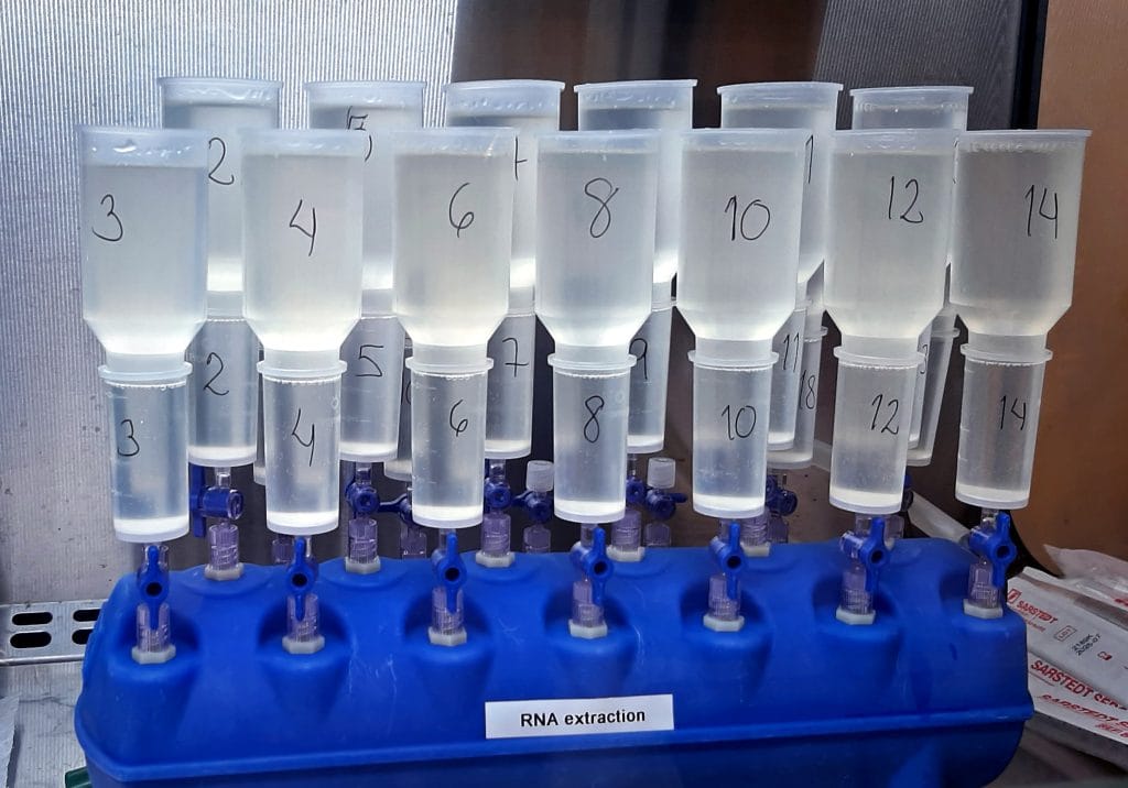 Dette billede illustrere Jagar hepatit- och influensavirus i avloppsvattnet